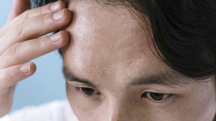 tratamentos para hiperidrose